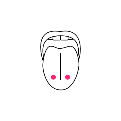 Illustration einer Zunge mit Venom Bites Piercings auf weißem Hintergrund, zwei pinke Punkte markieren die Positionen.
